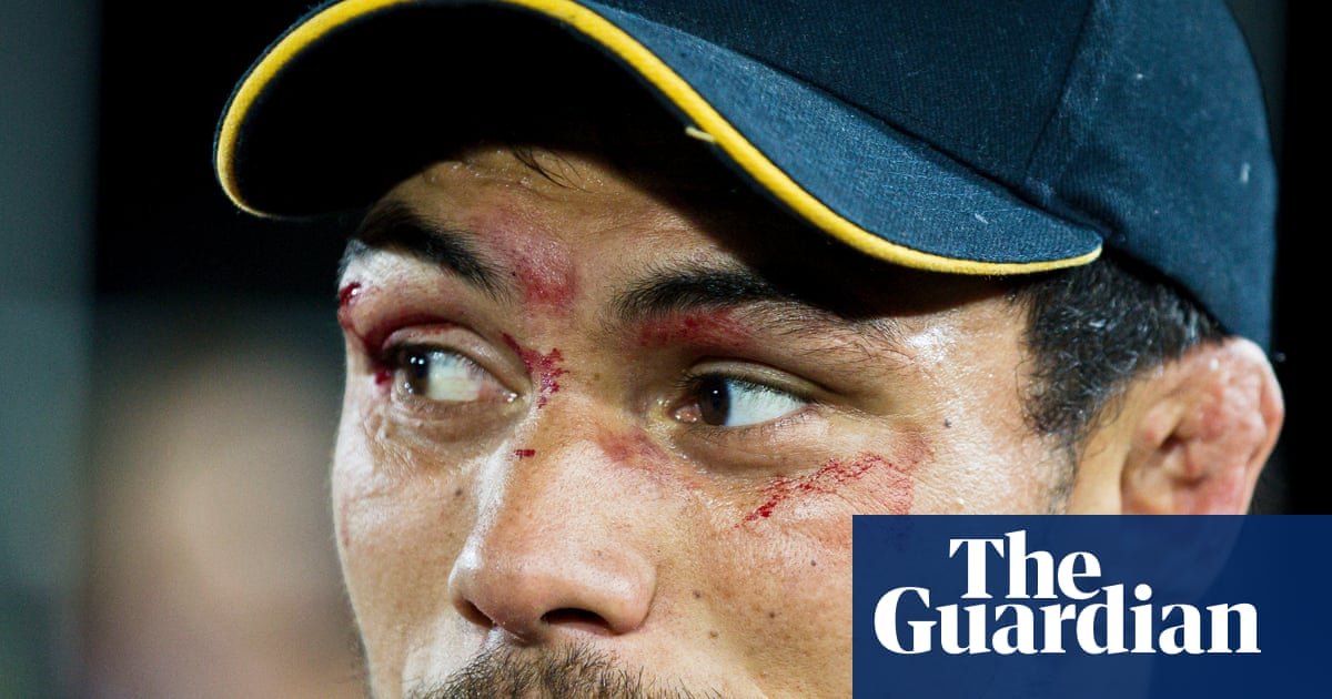 Shane Christie sustained a number of head accidents taking part in rugby. In dying, he’s nonetheless combating for change | New Zealand Shane Christie sustained a number of head accidents taking part in rugby. In dying, he’s nonetheless combating for change | New Zealand